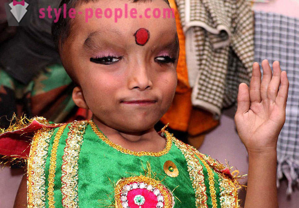 Satul indian este venerat băiat cu un cap deformat ca un zeu Ganesha
