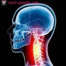 Exerciții în osteocondrozei a vertebrelor cervicale, toracice, lombare și sacrale